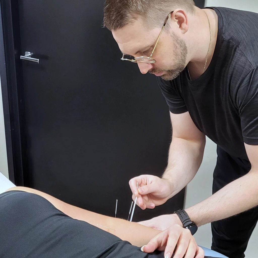 akupunktio seinäjoki